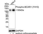 Phospho-p130Cas (Tyr410) Recombinant Rabbit Monoclonal Antibody (JE47-97)