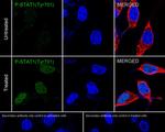 Phospho-STAT1 (Tyr701) Antibody in Immunocytochemistry (ICC/IF)