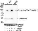 Phospho-STAT1 (Tyr701) Antibody in Western Blot (WB)
