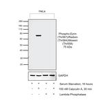 Phospho-Ezrin/Radixin/Moesin (Thr567, Thr564, Thr558) Antibody