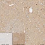 Phospho-DNM1L (Ser616) Antibody in Immunohistochemistry (Paraffin) (IHC (P))