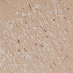 Phospho-DNM1L (Ser616) Antibody in Immunohistochemistry (Paraffin) (IHC (P))