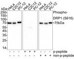 Phospho-DNM1L (Ser616) Antibody in Western Blot (WB)