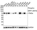 Phospho-DNM1L (Ser616) Antibody in Western Blot (WB)