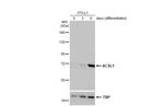 ACSL1 Antibody in Western Blot (WB)