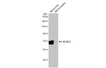 ACSL1 Recombinant Rabbit Monoclonal Antibody (HL1651)