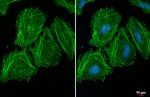 Actin Recombinant Rabbit Monoclonal Antibody (HL2372)