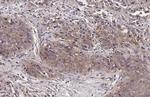 ADAMTSL2 Antibody in Immunohistochemistry (Paraffin) (IHC (P))