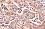 AKT1 Antibody in Immunohistochemistry (Paraffin) (IHC (P))