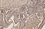 AKT1 Antibody in Immunohistochemistry (Paraffin) (IHC (P))