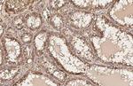 AKT1 Antibody in Immunohistochemistry (Paraffin) (IHC (P))