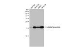 alpha Synuclein Antibody in Western Blot (WB)