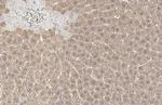 Arginase 1 Antibody in Immunohistochemistry (Paraffin) (IHC (P))