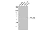 ARL13B Recombinant Rabbit Monoclonal Antibody (HL3179)