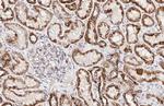 ATP5J Antibody in Immunohistochemistry (Paraffin) (IHC (P))