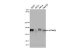 Ataxin 2 Antibody in Western Blot (WB)