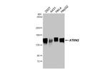 Ataxin 2 Antibody in Western Blot (WB)
