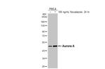 Aurora A Antibody in Western Blot (WB)