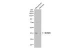 BCKDK Antibody in Western Blot (WB)