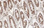 BCL-XL Antibody in Immunohistochemistry (Paraffin) (IHC (P))