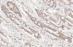 BCL-XL Antibody in Immunohistochemistry (Paraffin) (IHC (P))