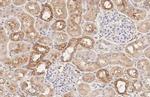 Beclin 1 Antibody in Immunohistochemistry (Paraffin) (IHC (P))
