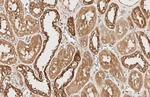 Beclin 1 Antibody in Immunohistochemistry (Paraffin) (IHC (P))
