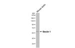 Beclin 1 Antibody in Western Blot (WB)