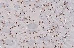 BRD4 Antibody in Immunohistochemistry (Paraffin) (IHC (P))