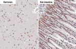 BRD4 Antibody in Immunohistochemistry (Paraffin) (IHC (P))