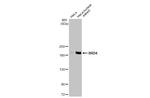 BRD4 Antibody in Western Blot (WB)