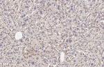 BSEP Antibody in Immunohistochemistry (Paraffin) (IHC (P))