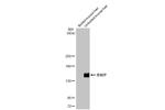 BSEP Antibody in Western Blot (WB)