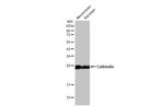 Calbindin D28K Antibody in Western Blot (WB)
