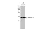 Calcineurin B Antibody in Western Blot (WB)