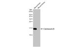 Calcineurin B Antibody in Western Blot (WB)