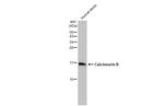 Calcineurin B Antibody in Western Blot (WB)