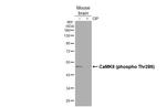 Phospho-CaMKII alpha (Thr286) Antibody in Western Blot (WB)