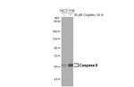 Caspase 8 Recombinant Rabbit Monoclonal Antibody (HL2914)