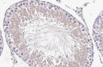 NOV Antibody in Immunohistochemistry (Paraffin) (IHC (P))