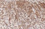 CCR1 Antibody in Immunohistochemistry (Paraffin) (IHC (P))