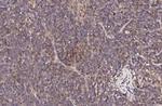 CCR1 Antibody in Immunohistochemistry (Paraffin) (IHC (P))