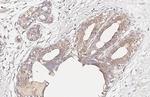 CCR1 Antibody in Immunohistochemistry (Paraffin) (IHC (P))