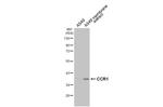 CCR1 Antibody in Western Blot (WB)