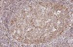 CCR7 Antibody in Immunohistochemistry (Paraffin) (IHC (P))