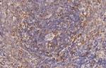 CCR7 Recombinant Rabbit Monoclonal Antibody (HL3075)