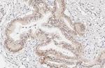 CCR9 Antibody in Immunohistochemistry (Paraffin) (IHC (P))