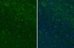 CD11b Antibody in Immunohistochemistry (Paraffin) (IHC (P))
