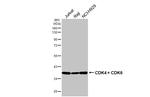 CDK4/CDK6 Recombinant Rabbit Monoclonal Antibody (HL2323)