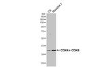 CDK4/CDK6 Antibody in Western Blot (WB)